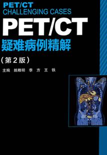 境灵世
